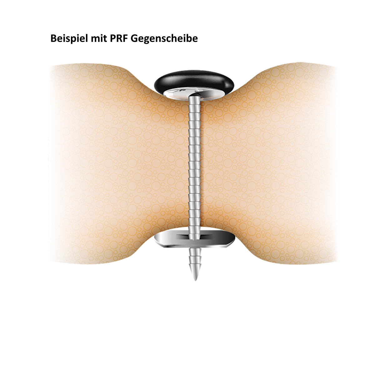 Astor-Knopfunterteil 28 (UT PR E H) 17 mm Nagel, geriffelter Polsternagel, metall, 1000 Stück, 6423828